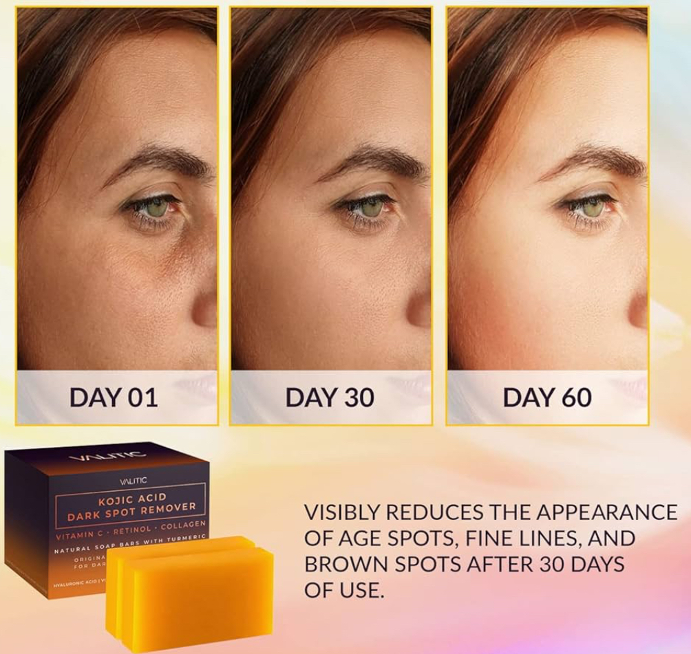 VALITIC Kojic Acid Dark Spot Remover Soap Bars with Vitamin C, Retinol, Collagen, Turmeric - Original Japanese Complex Infused with Hyaluronic Acid, Vitamin E, Shea Butter, Castile Olive Oil (2 Pack) - Image 3