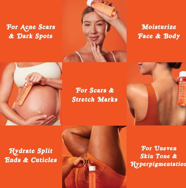 Bio-Oil Skincare Body Oil Serum, Face and Body Moisturizer with Vitamin E & A, for Scars, Stretch Marks, Sensitive Skin, All Skin Types, Dermatologist Recommended, Non-Comedogenic, 6.7 Oz - Image 3