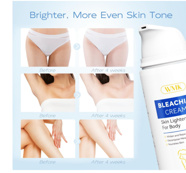 WMK Skin Lightening Cream for Intimate Areas – Vitamin C Dark Spot Remover for Underarms, Knees, Elbows & Bikini Line - Image 2