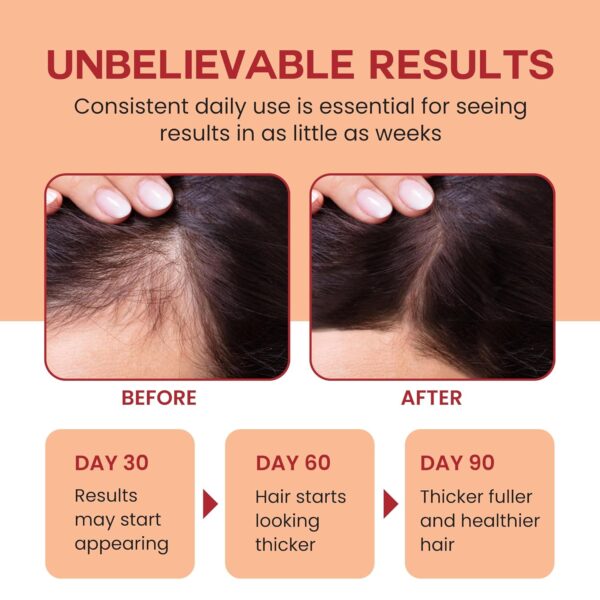 Raw Batana Oil for Hair Growth - 100% Pure, Organic 4oz Batana from Honduras for Thick and Strong Natural Hair - Dr. Sebi Unrefined Cold Pressed Cosmetic Scalp Mask for Men & Women (1 Pack) - Image 2